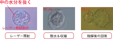artificial_shrinkage法