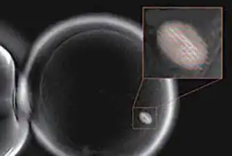 第一極体から離れた紡錘体(スピンドル)
