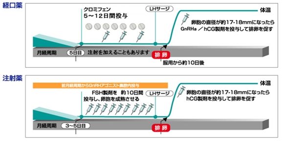 体外受精のながれ リプロダクションセンター 不妊治療 体外受精 内視鏡手術 新百合ヶ丘総合病院