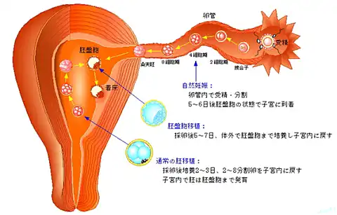 イラスト画像