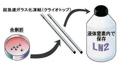 凍結方法